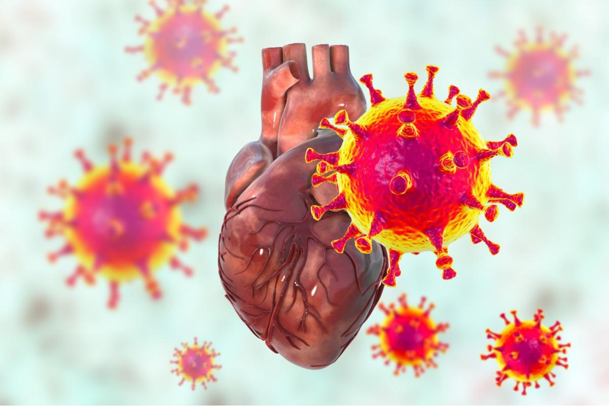 Study: Genetic alteration of human MYH6 is mimicked by SARS-CoV-2 polyprotein: mapping viral variants of cardiac interest. Image Credit: Kateryna Kon/Shutterstock