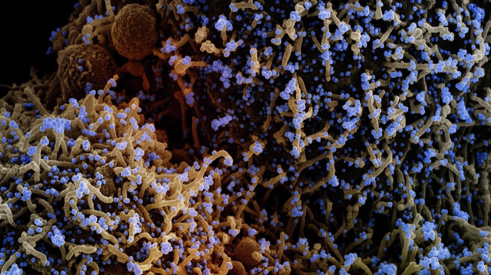 Study: Effectiveness and durability of protection against future SARS-CoV-2 infection conferred by COVID-19 vaccination and previous infection; findings from the UK SIREN prospective cohort study of healthcare workers March 2020 to September 2021. Image Credit: NIAID