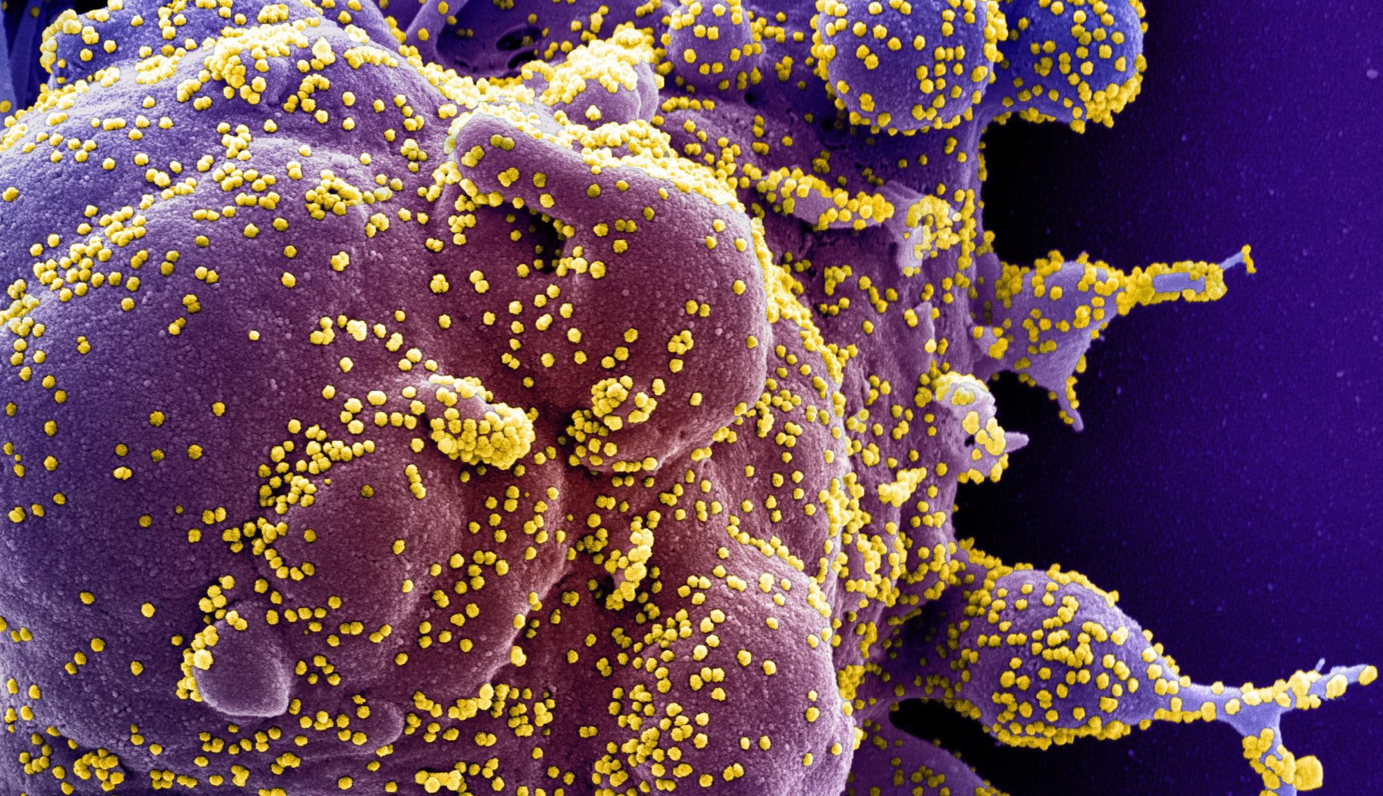 Study: RT-PCR/MALDI-TOF diagnostic target performance reflects circulating SARS-CoV-2 variant diversity in New York City. Image Credit: NIAID