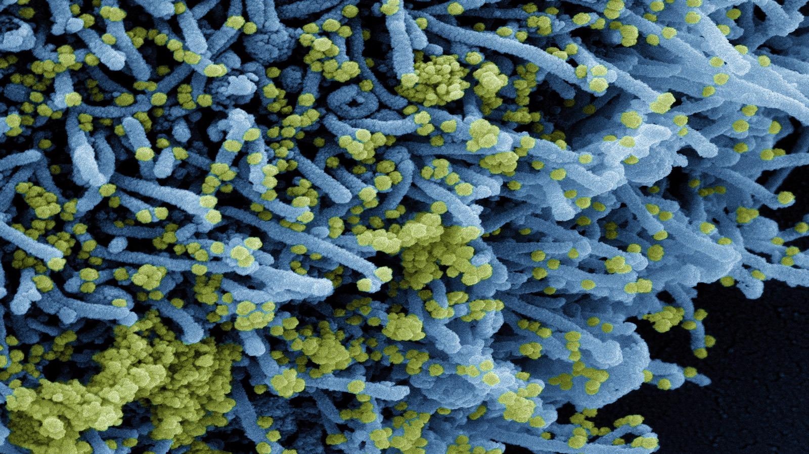 Study: BNT162b2 Vaccine Booster and Mortality Due to Covid-19. Image Credit: NIAID