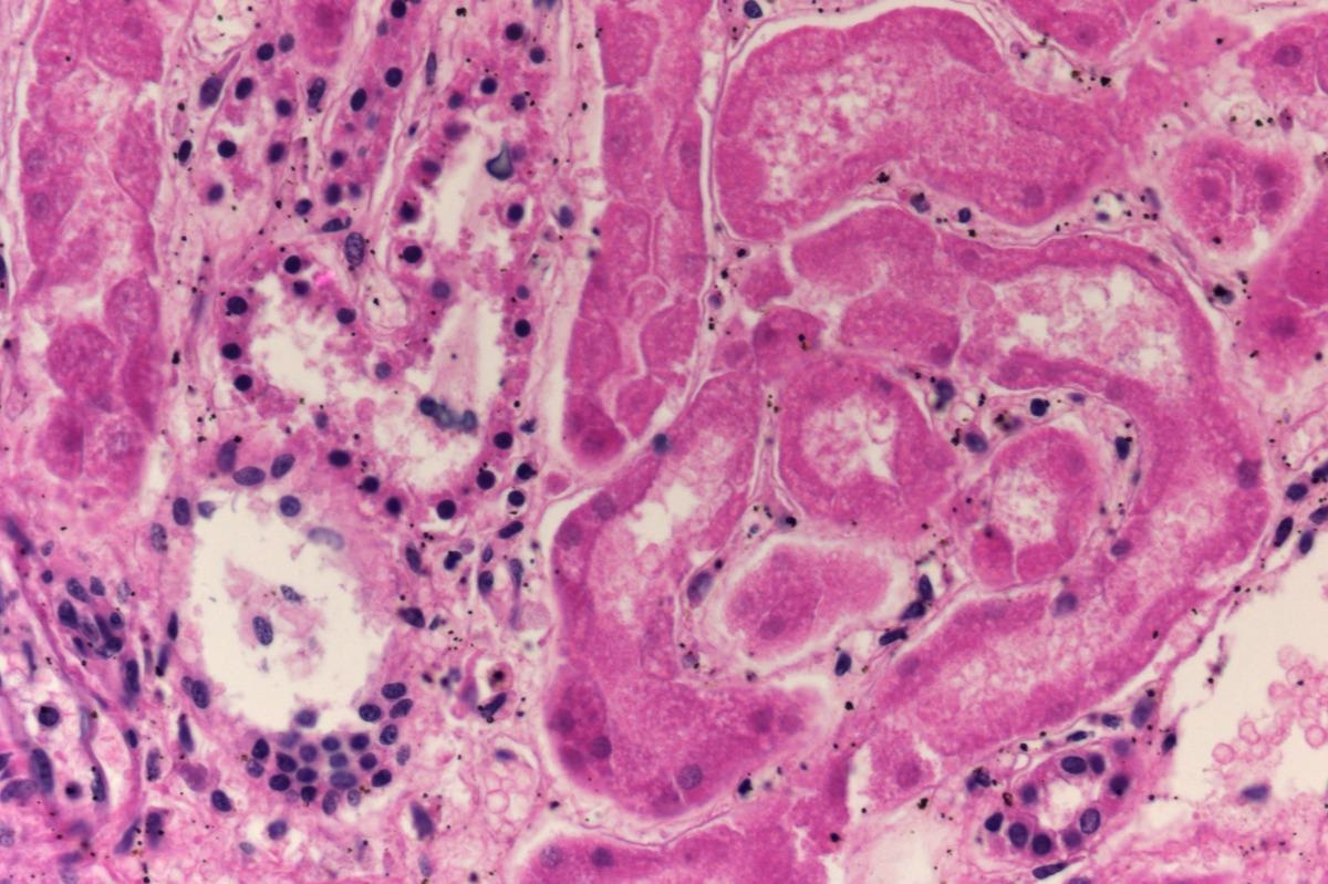 Study: Transcriptomic responses of the human kidney to acute injury at single cell resolution. Image Credit: Arisang/Shutterstock