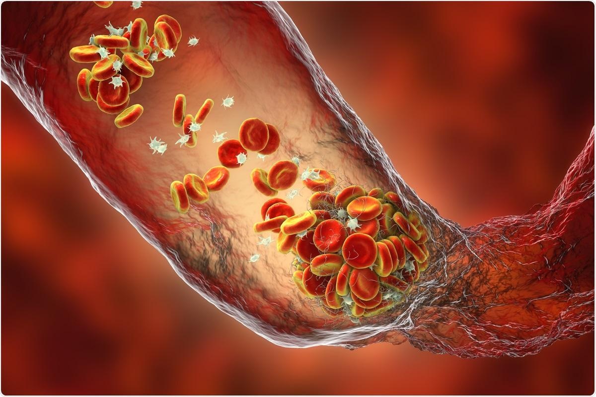 Study: SARS-CoV-2 Spike protein activates TMEM16F-mediated platelet pro-coagulant activity. Image Credit: Kateryna Kon / Shutterstock.com