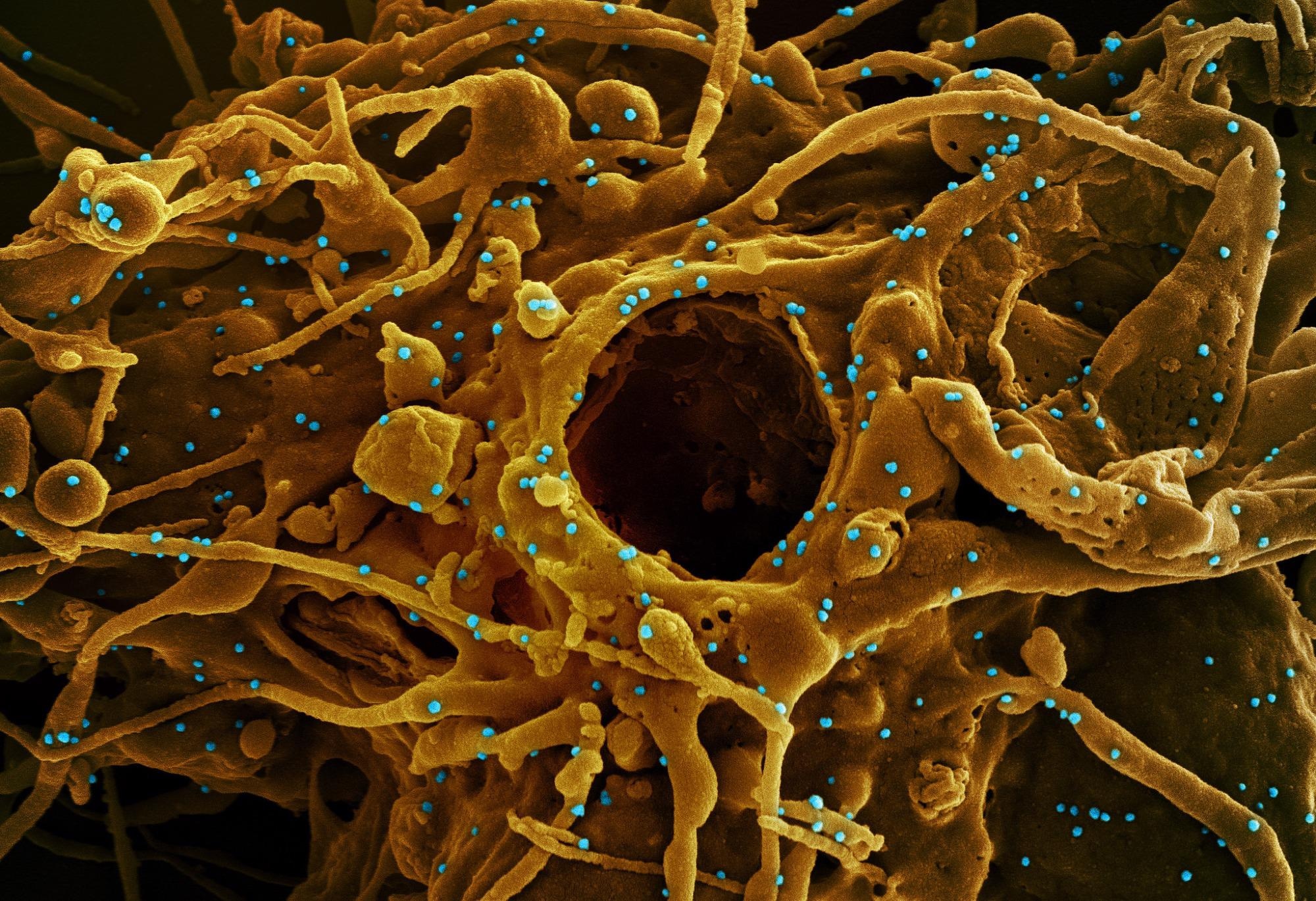 Study: Immunosequencing and epitope mapping reveal substantial preservation of the T cell immune response to Omicron generated by SARS-CoV-2 vaccines. Image Credit: NIAID