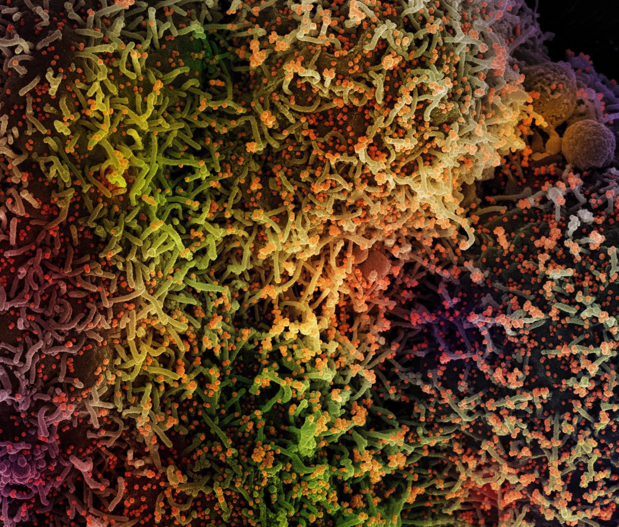 Study: Persistence of endogenous SARS-CoV-2 and pepper mild mottle virus RNA in wastewater settled solids. Image Credit: NIAID