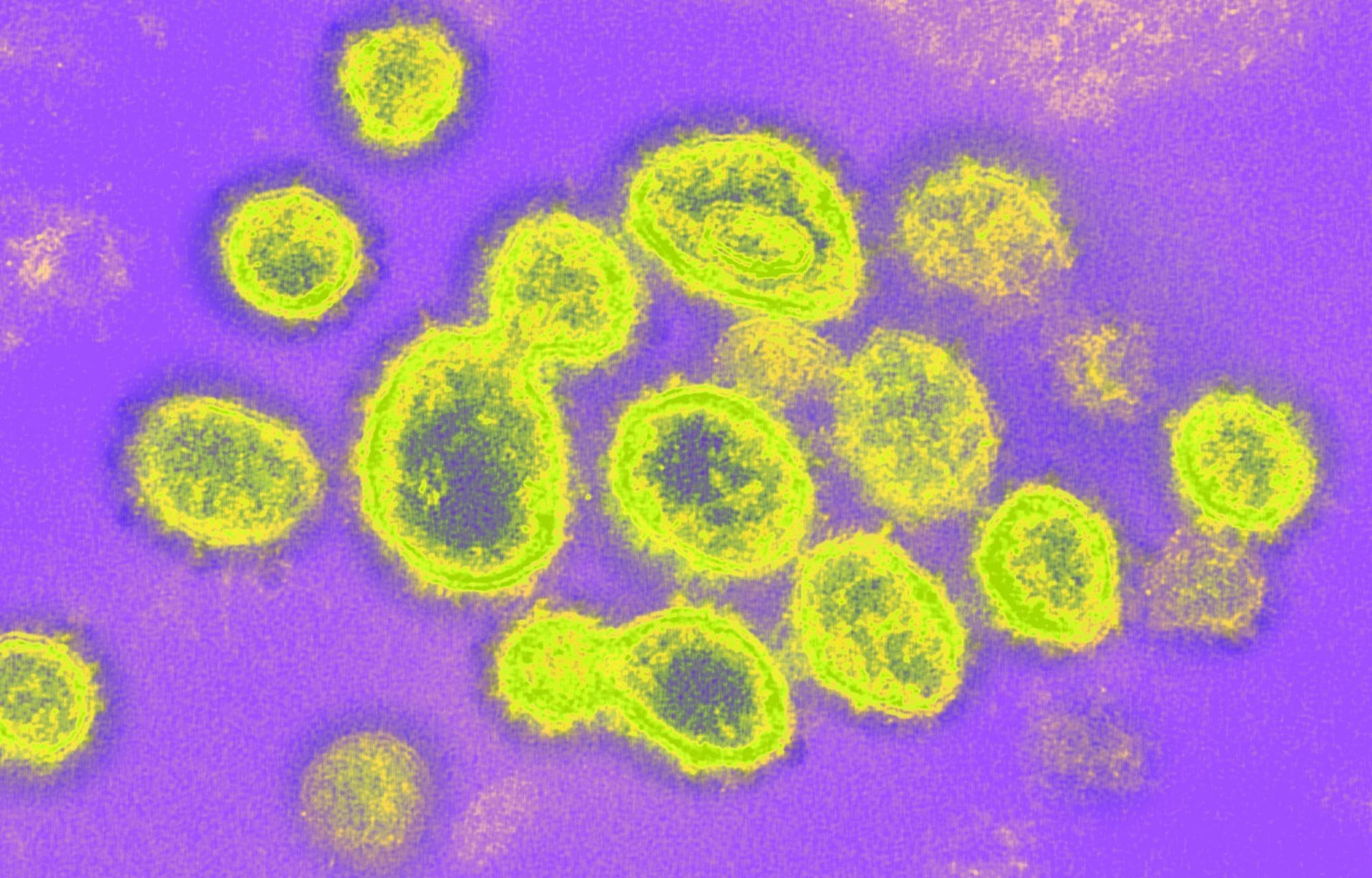 Study: The Age-Related Probability of Dying from COVID-19 among Those Infected: A Relative Survival Analysis. Image Credit: NIAID