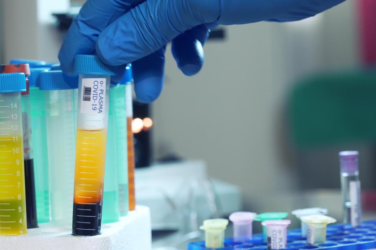 Study: A role for Nucleocapsid-specific antibody function in Covid-19 Convalescent plasma therapy. Image Credit: JHDT Productions/Shutterstock
