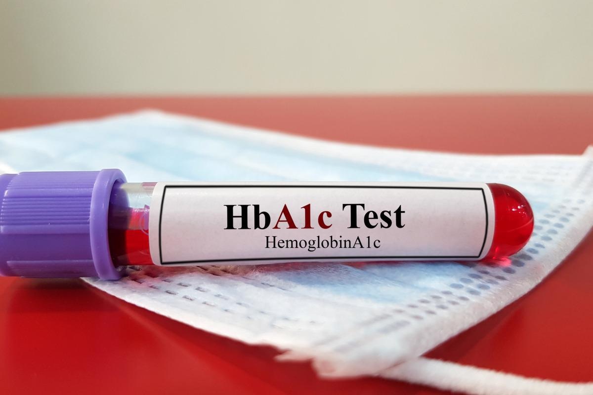 Study: Impacts of COVID-19 on glycemia and risk of diabetic ketoacidosis. Image Credit: joel bubble ben/Shutterstock