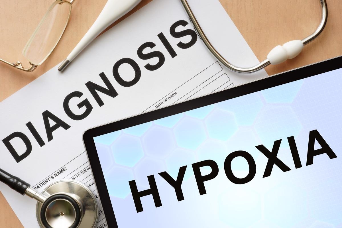 Study: Hypoxia inducible factors regulate infectious SARS-CoV-2, epithelial damage and respiratory symptoms in a hamster COVID-19 model. Image Credit: Vitalii Vodolazskyi/Shutterstock