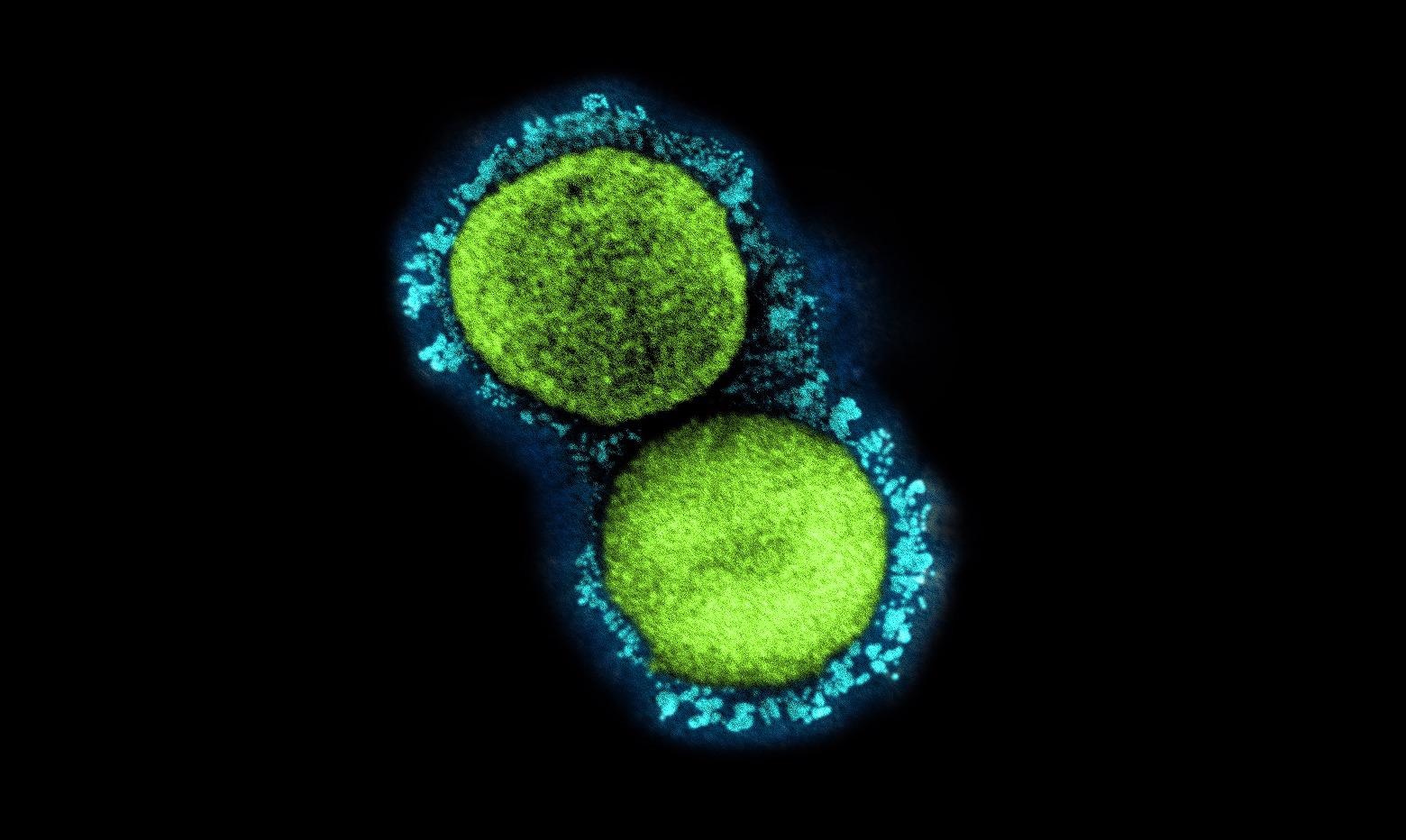 Study: A conserved immune trajectory of recovery in hospitalized COVID-19 patients. Image Credit: NIAID
