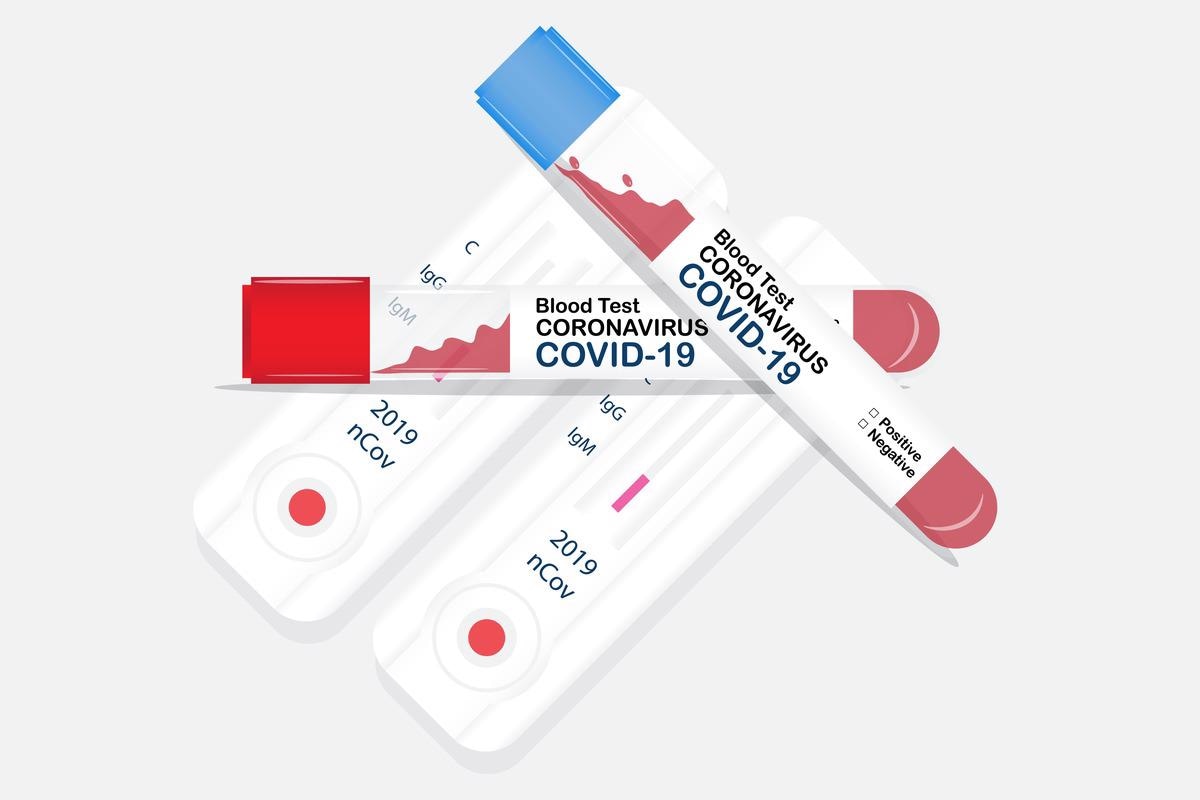 Study: T-cell Receptor Sequencing Identifies Prior SARS-Cov-2 Infection And Correlates with Neutralizing Antibodies And Disease Severity. Image Credit: Panggabean / Shutterstock.com