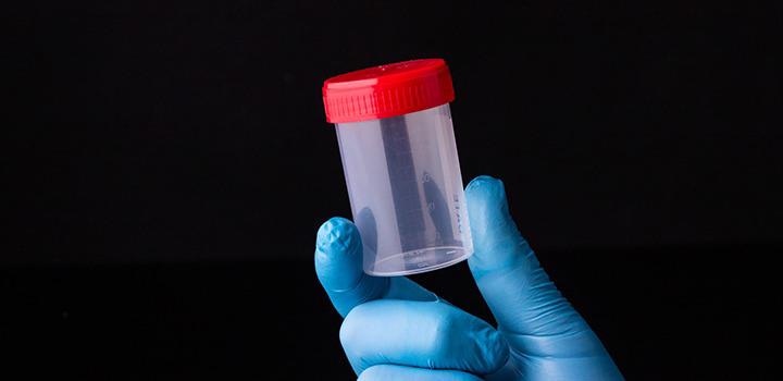 Researchers identify five types of bacteria in men with aggressive prostate cancer