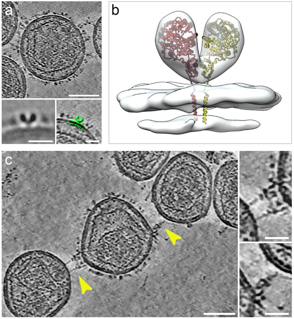 Cryogenic electron tomography of hACE2 nanoparticles reveals their interaction with SARS-CoV-2 pseudoviruses.All virtual slices in this figure are 12-nm thick. Bars in main panels = 50 nm; bars in insets = 20 nm. (a) Slice through a tomogram of an hACE2 nanoparticle showing dense decoration with hACE2 dimers. Insets show two-dimensional average of the protein density protruding from the nanoparticles (left) and overlay with surface representation (green) of three-dimensional (3D) reconstruction of membrane-bound particles (right). (b) Surface representation of 3D reconstruction obtained by sub-tomogram averaging of membrane-bound particles (Extended Data Figure 2). The atomic structure of the ACE2 dimer (monomers in yellow and red), extracted from the open conformation of the hACE2-B0AT1 complex (PDB: 6MD1), was fitted into the density showing a good match. (c) Virtual slice through a tomogram of hACE2 nanoparticles interacting with SARS-CoV-2 pseudoviruses. Interactions between hACE2 and spikes are marked with yellow arrowheads. Insets show close-up views of interactions between hACE2 nanoparticles and spike marked by the yellow arrowheads.