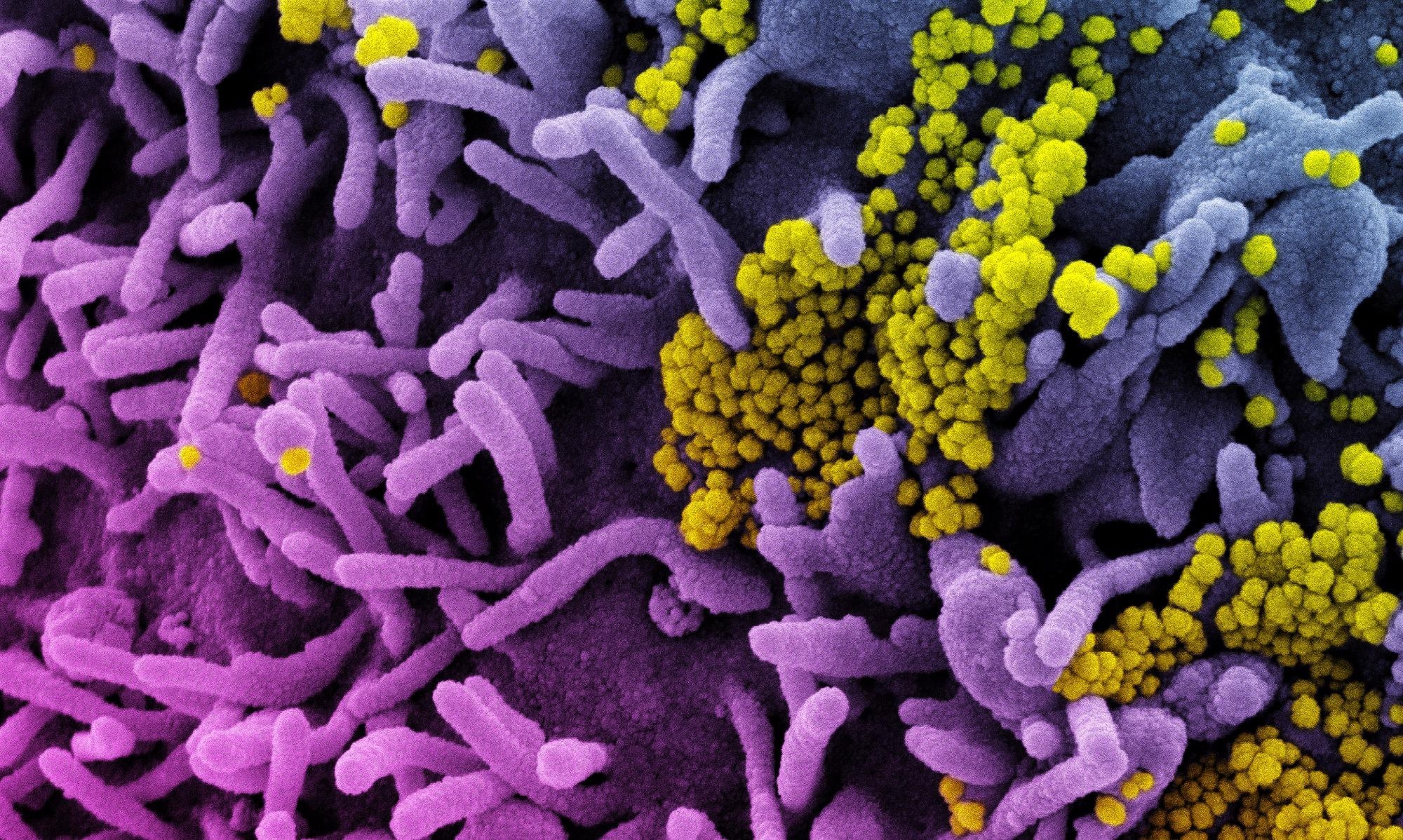 Study: Real-world effectiveness of molnupiravir and nirmatrelvir/ritonavir among COVID-19 inpatients during Hong Kong’s Omicron BA.2 wave: an observational study. Image Credit: NIAID