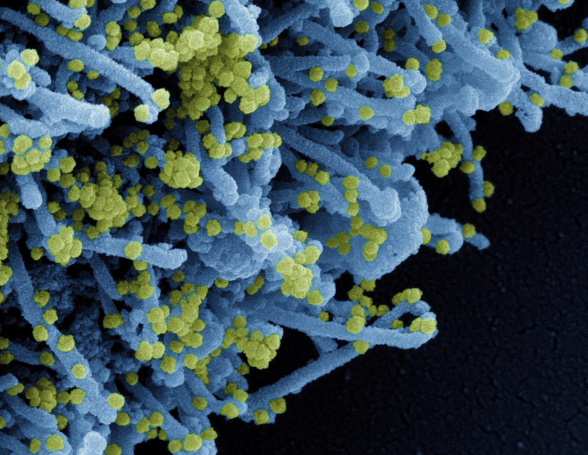Study: SARS-CoV-2 type I Interferon modulation by nonstructural proteins 1 and 2. Image Credit: NIAID