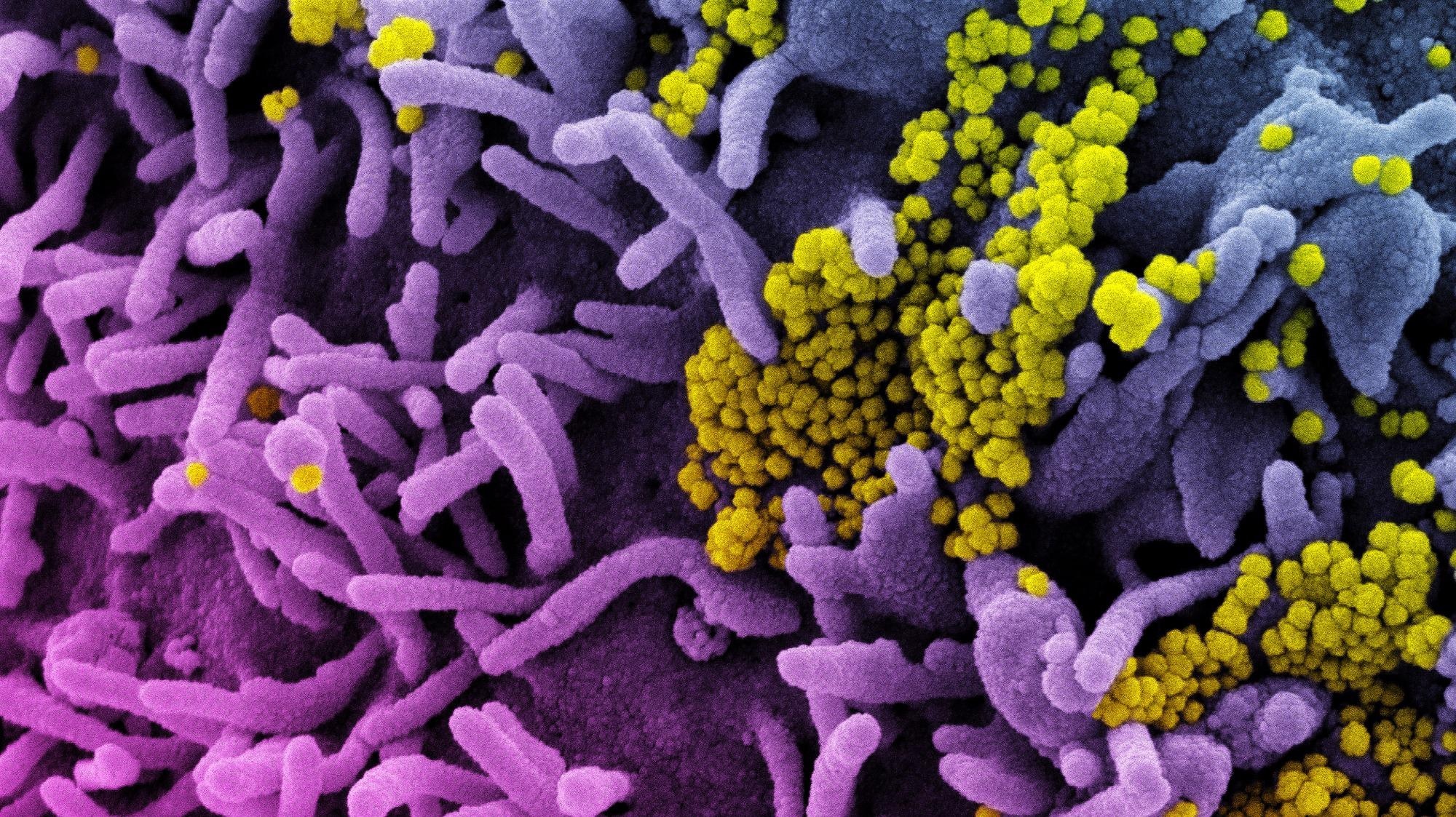 Study: The Omicron variant BA.1.1 presents a lower pathogenicity than B.1 D614G and Delta variants in a feline model of SARS-CoV-2 infection. Image Credit: NIAID