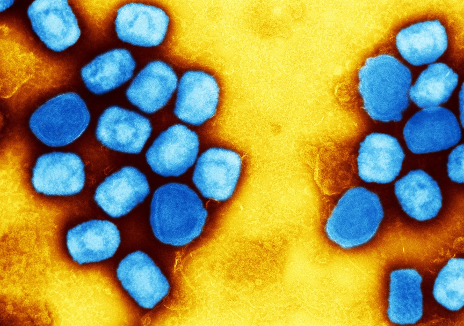 Study: Infection-competent monkeypox virus contamination identified in domestic settings following an imported case of monkeypox into the UK. Image Credit: NIAID