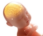 Prenatal bisphenol A exposure may affect brain volume in children