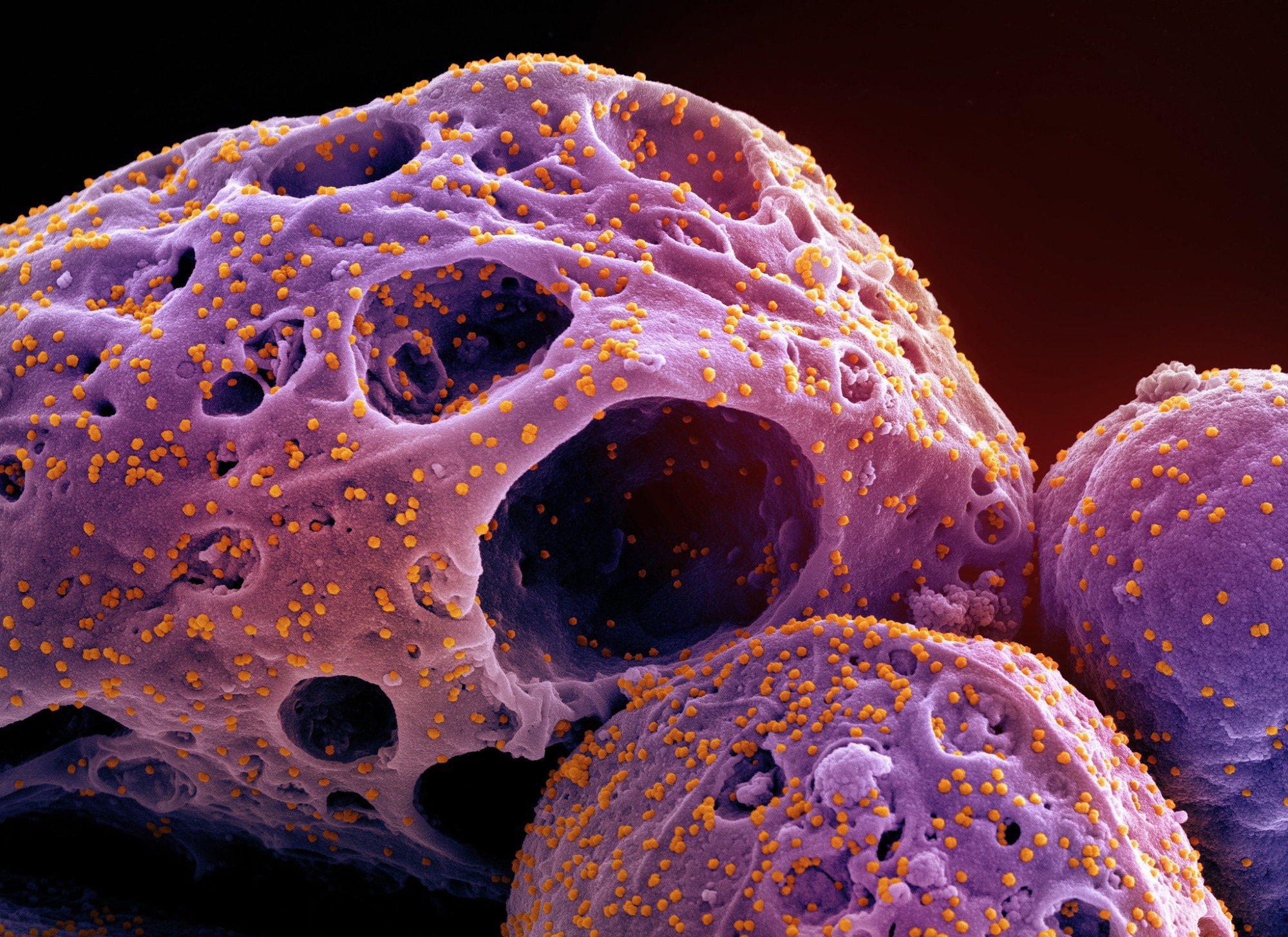 Study: mRNA bivalent booster enhances neutralization against BA.2.75.2 and BQ.1.1. Image Credit: NIAID