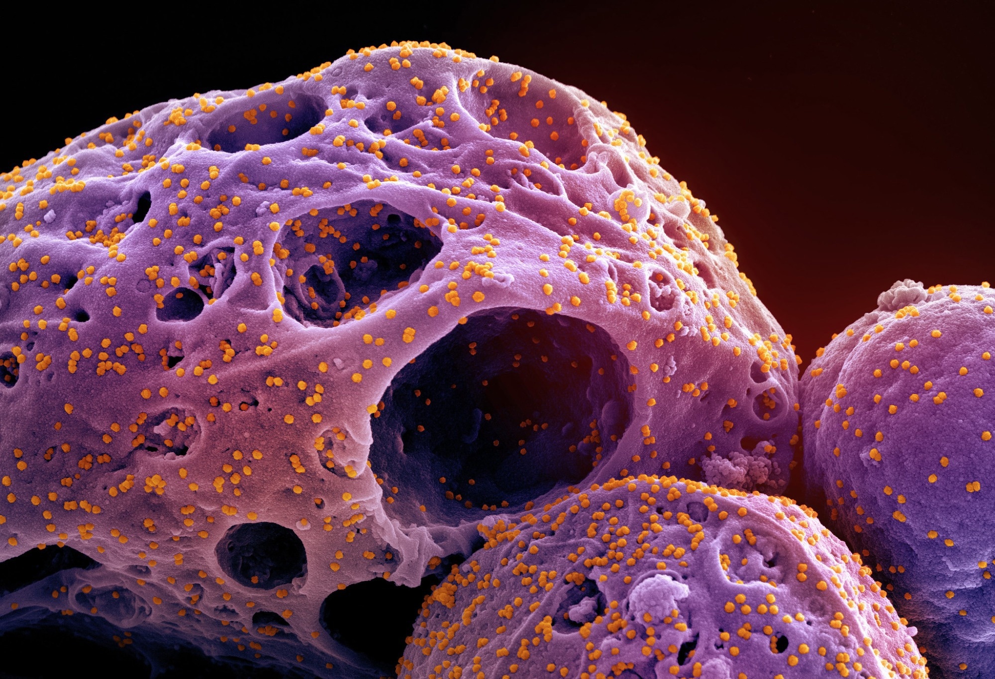 Study: Novel inhibitors against COVID-19 main protease suppressed viral infection. Image Credit: NIAID