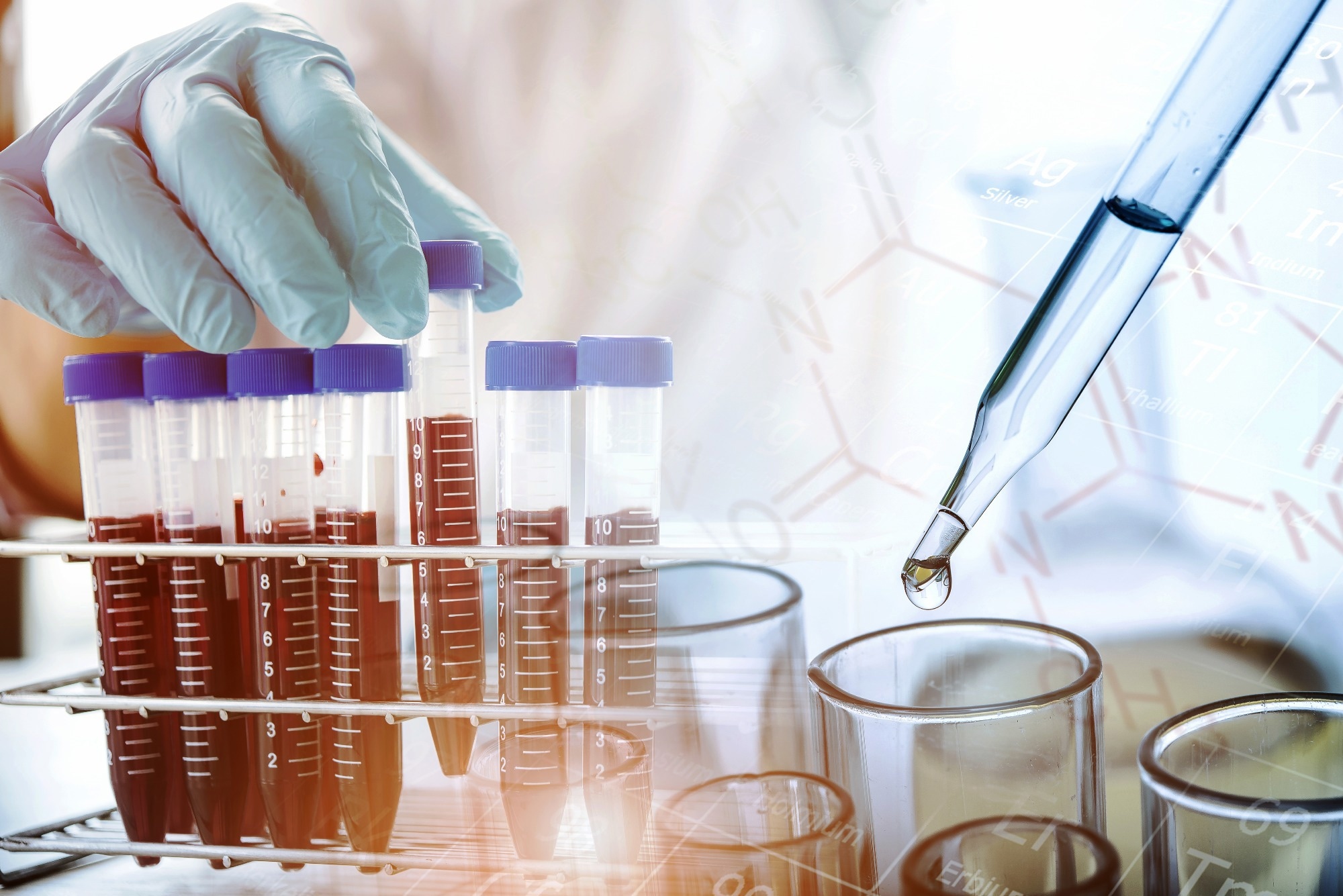 Study: Multi-omics microsampling for the profiling of lifestyle-associated changes in health. Image Credit: totojang1977/Shutterstock