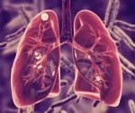 Incidence of tuberculosis reaches 2.5 cases per 100,00 in the U.S.
