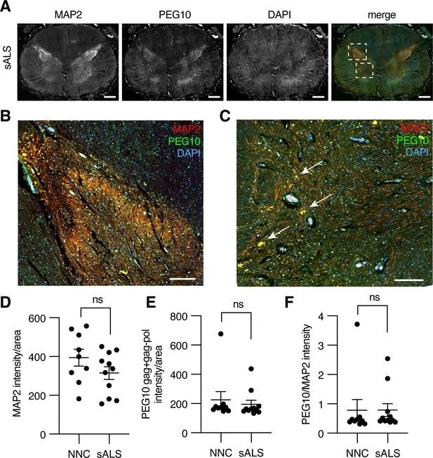 Paternally expressed gene 10 (PEG10) is enriched in horns of the lumbosacral spinal cord. (A) Tiled image of full-thickness lumbosacral spinal cord section demonstrating Microtubule-associated protein 2 (MAP2), PEG10, and DAPI staining. Merged image shows outlines of boxes for closer examination in (B) and (C). Scale bar 1 mm. (B) Merged image of the posterior horn of the spinal cord showing enrichment for both MAP2 and PEG10 signals. Scale bar 200 μm. (C) Merged image of the anterior horn of the spinal cord showing colocalization of MAP2 and PEG10 signal in cell bodies (arrows). Scale bar 200 μm. (D–E) Quantitation of (D) MAP2 and (E) PEG10 signal in spinal cord sections. Signal intensity of MAP2 and PEG10 were determined per mm2 of spinal cord section for a cohort of non-neurological controls (NNC,