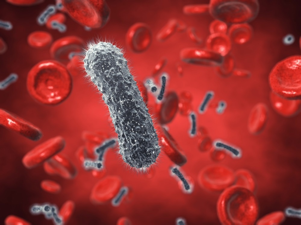 Study: Comparison of pathogen detection consistency between metagenomic next-generation sequencing and blood culture in patients with suspected bloodstream infection. Image Credit: nobeastsofierce/Shutterstock.com