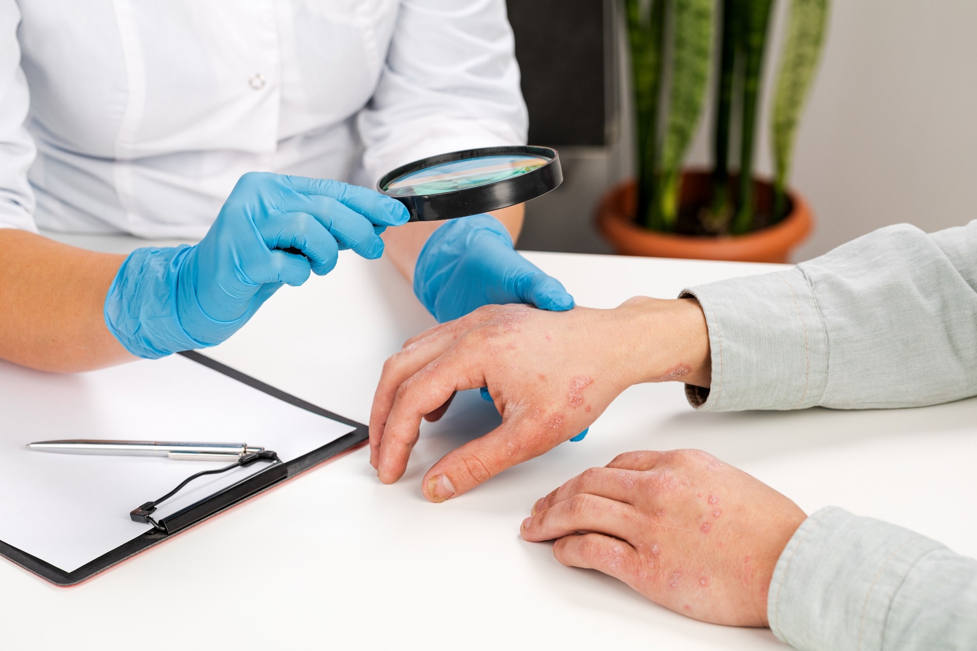 New Onset and Exacerbation of Psoriasis Following COVID-19 Vaccination: A Review of the Current Knowledge