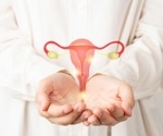 Key player in ovarian cancer may have implications for PCOS