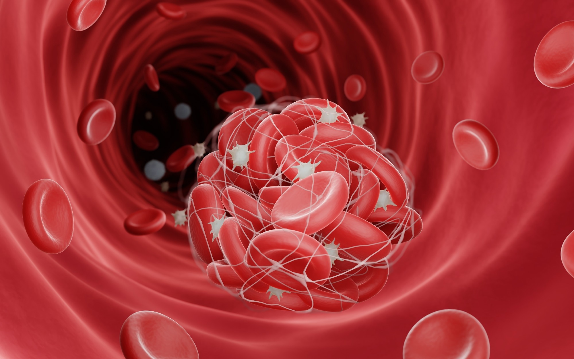 Study: Association of nonalcoholic fatty liver disease and venous thromboembolic disease in healthy adults in Korea: A nationwide study. Image Credit: ART-ur / Shutterstock.com