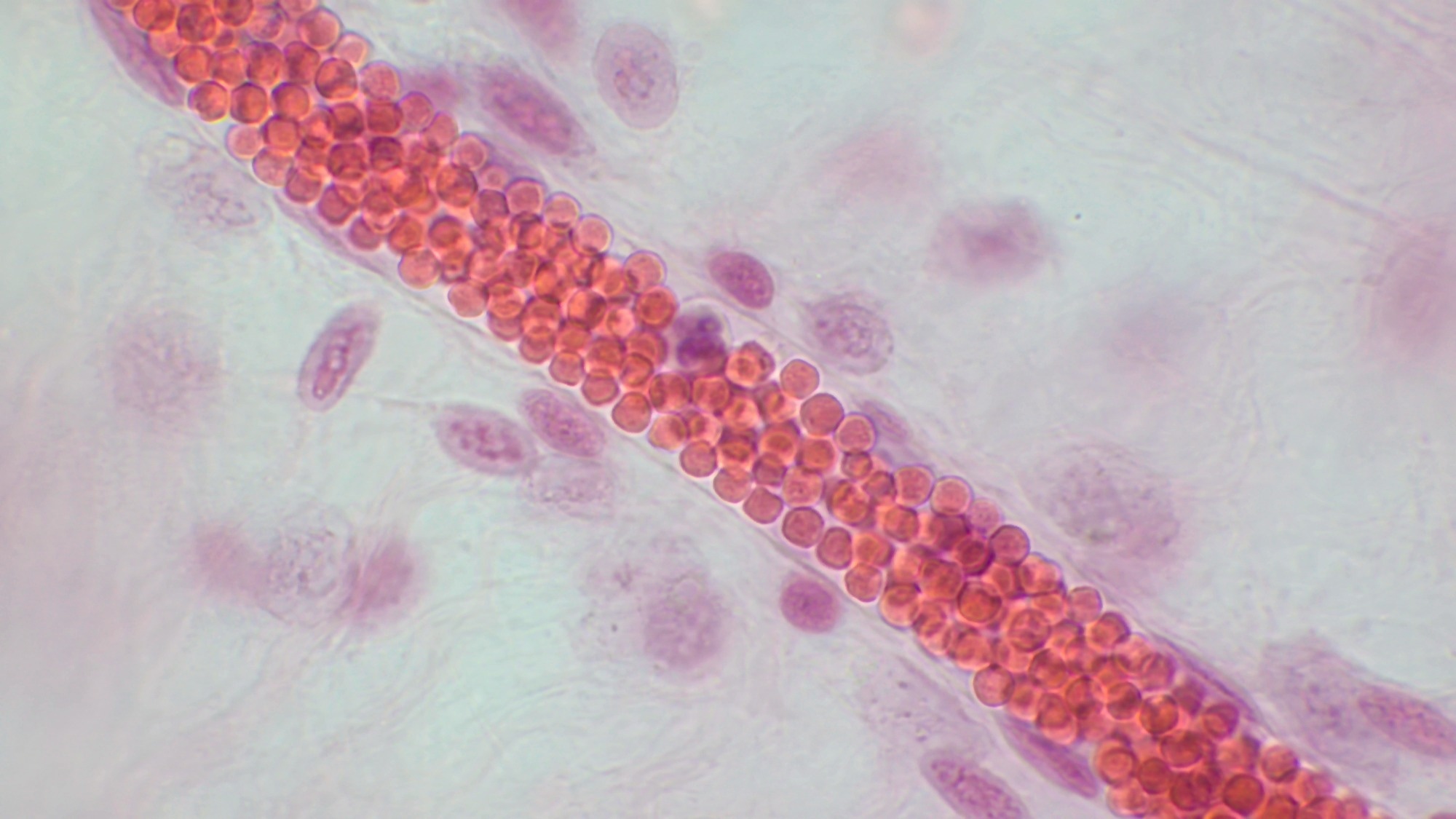 Spotlight “Bloody” good factors for keeping the brain young. Image Credit: BioFoto / Shutterstock