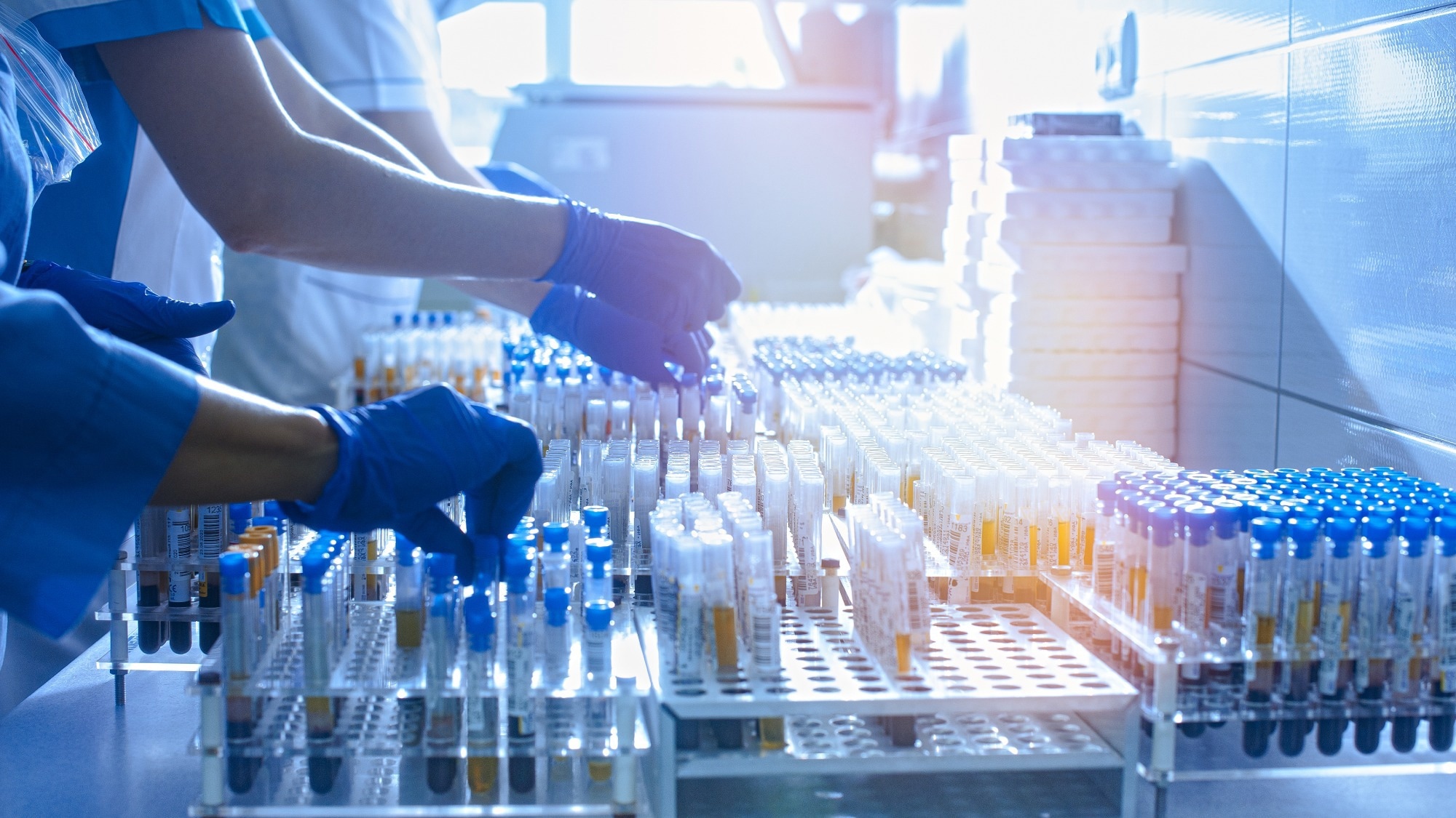 Samples in a laboratory