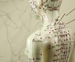 Study reveals acupuncture and massage as effective pain management in advanced cancer