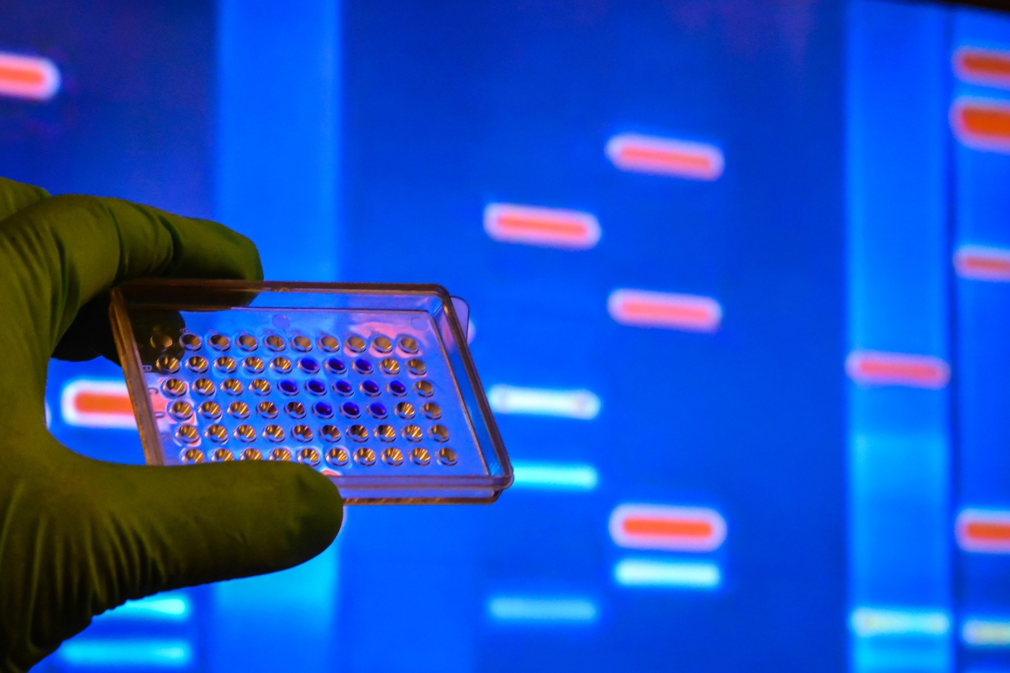 Study: Evidence review and recommendations for the implementation of genomics for antimicrobial resistance surveillance: reports from an international expert group Image Credit: Sergei Drozd / Shutterstock
