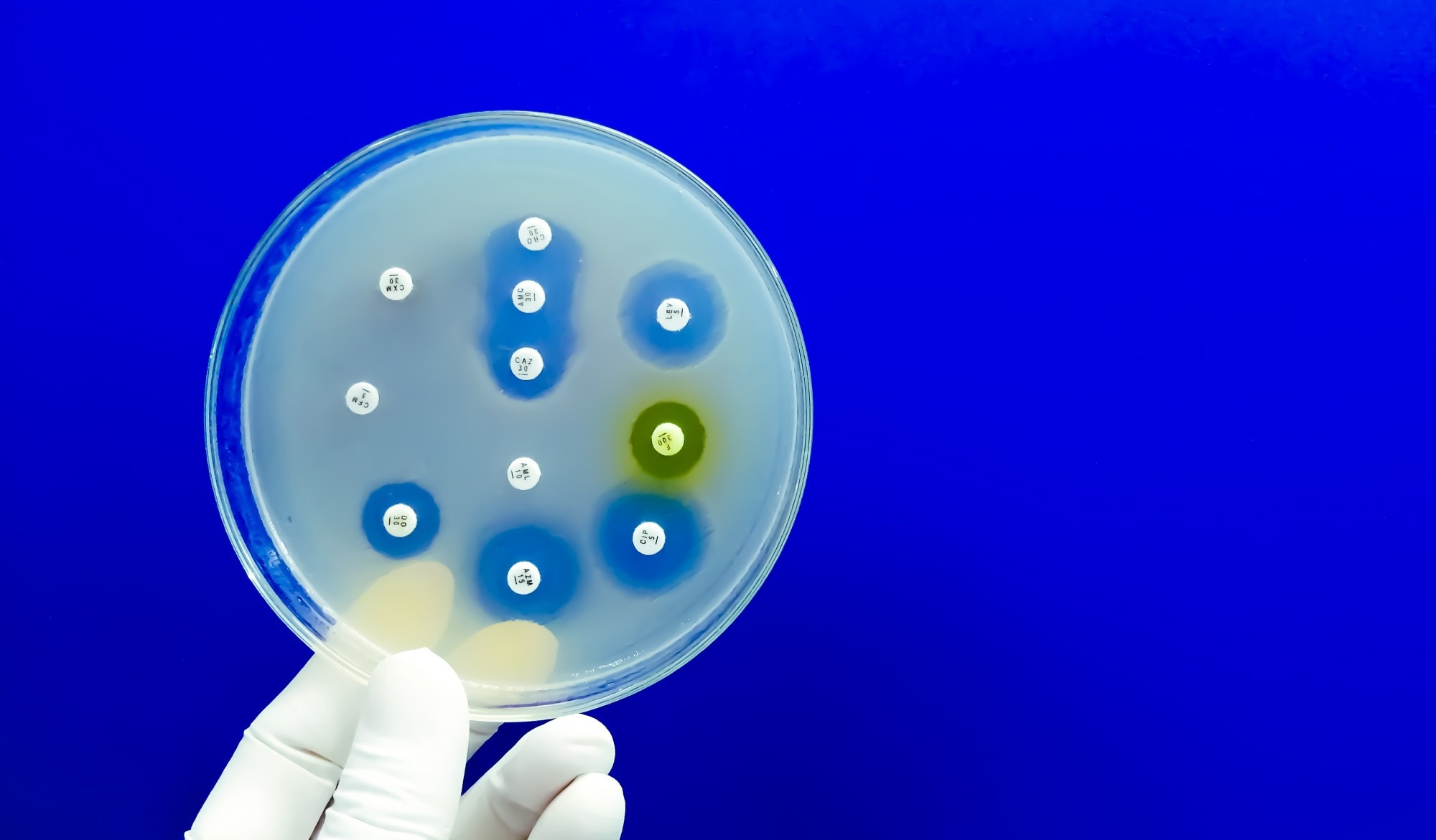 Study: Global pathogenomic analysis identifies known and candidate genetic antimicrobial resistance determinants in twelve species. Image Credit: Saiful52 / Shutterstock