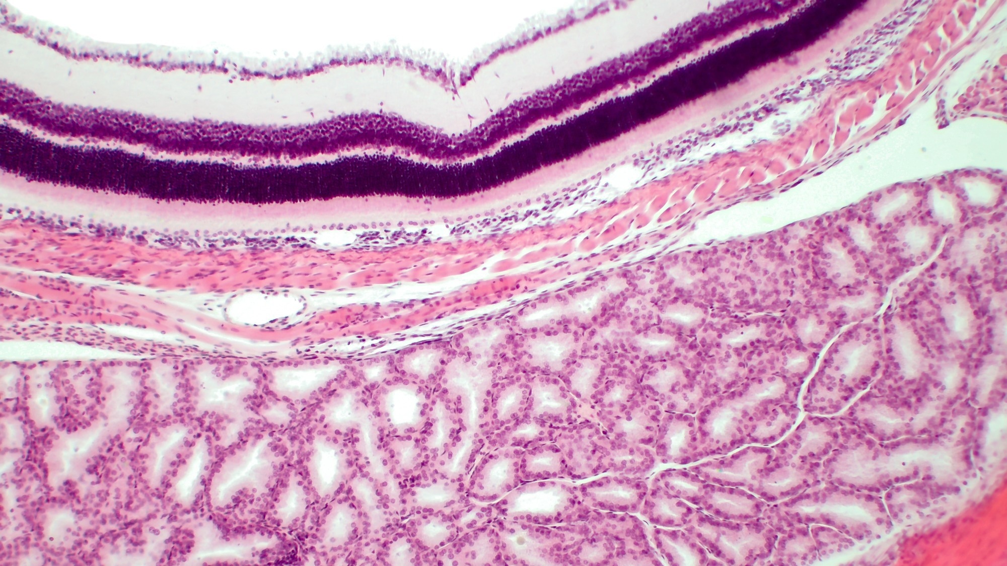 Using linear mixed-effects models adjusted for age at baseline and sex. Color represents the estimated atrophy rate in each foveo-centered area. Absolute rates are represented in the first two columns. The relative increase in PD vs. control is represented on the third column, and the corresponding significant p-values for group effect are represented in gray scale. Abbreviations: GCIPL: ganglion cell-inner plexiform layers; PD, Parkinson’s disease.