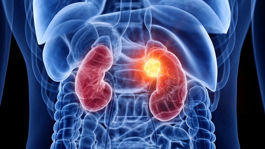 New AI-powered protein mapping tool optimizes cancer therapy