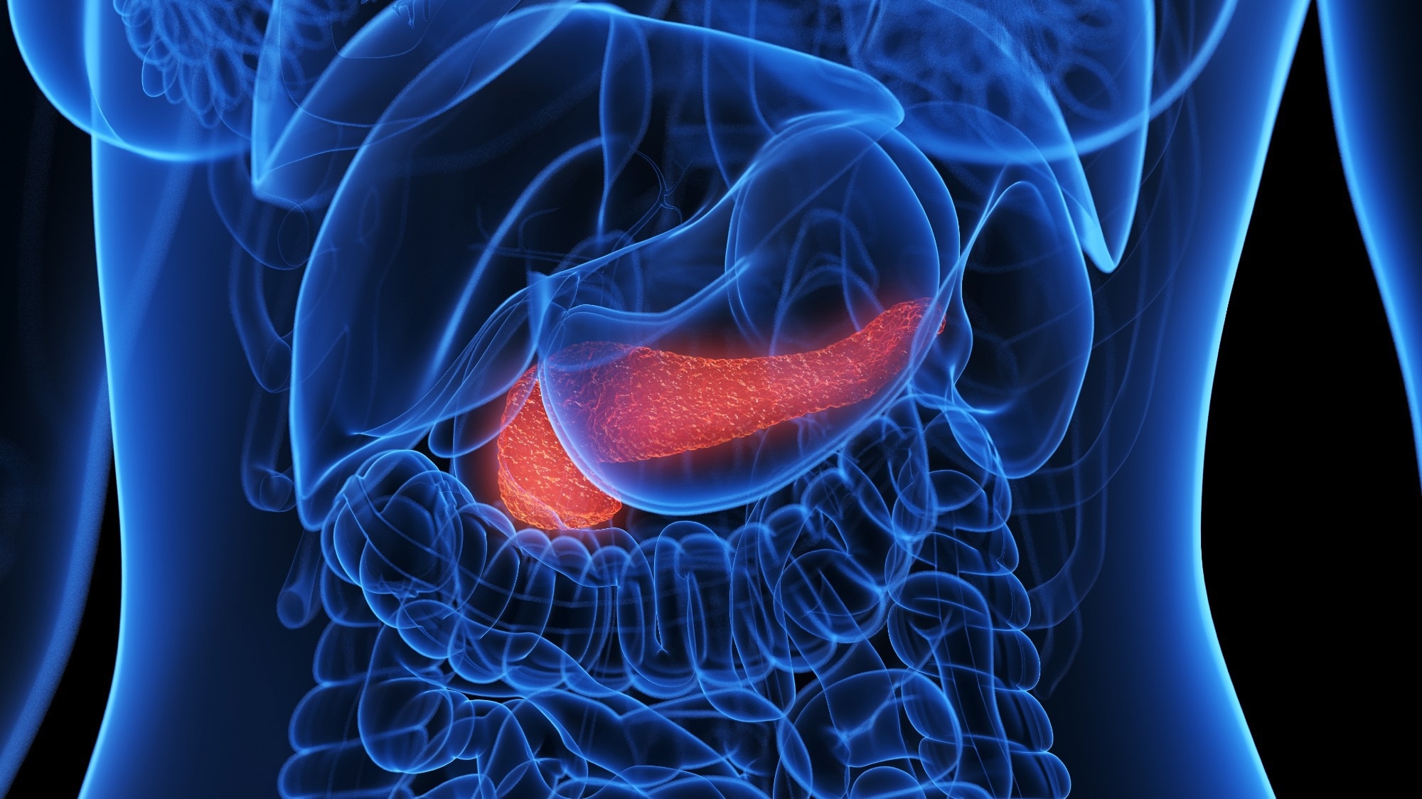 Study: Identification of biomarkers and potential therapeutic targets for pancreatic cancer by proteomic analysis in two prospective cohorts. Image Credit: Sebastian Kaulitzki / Shutterstock