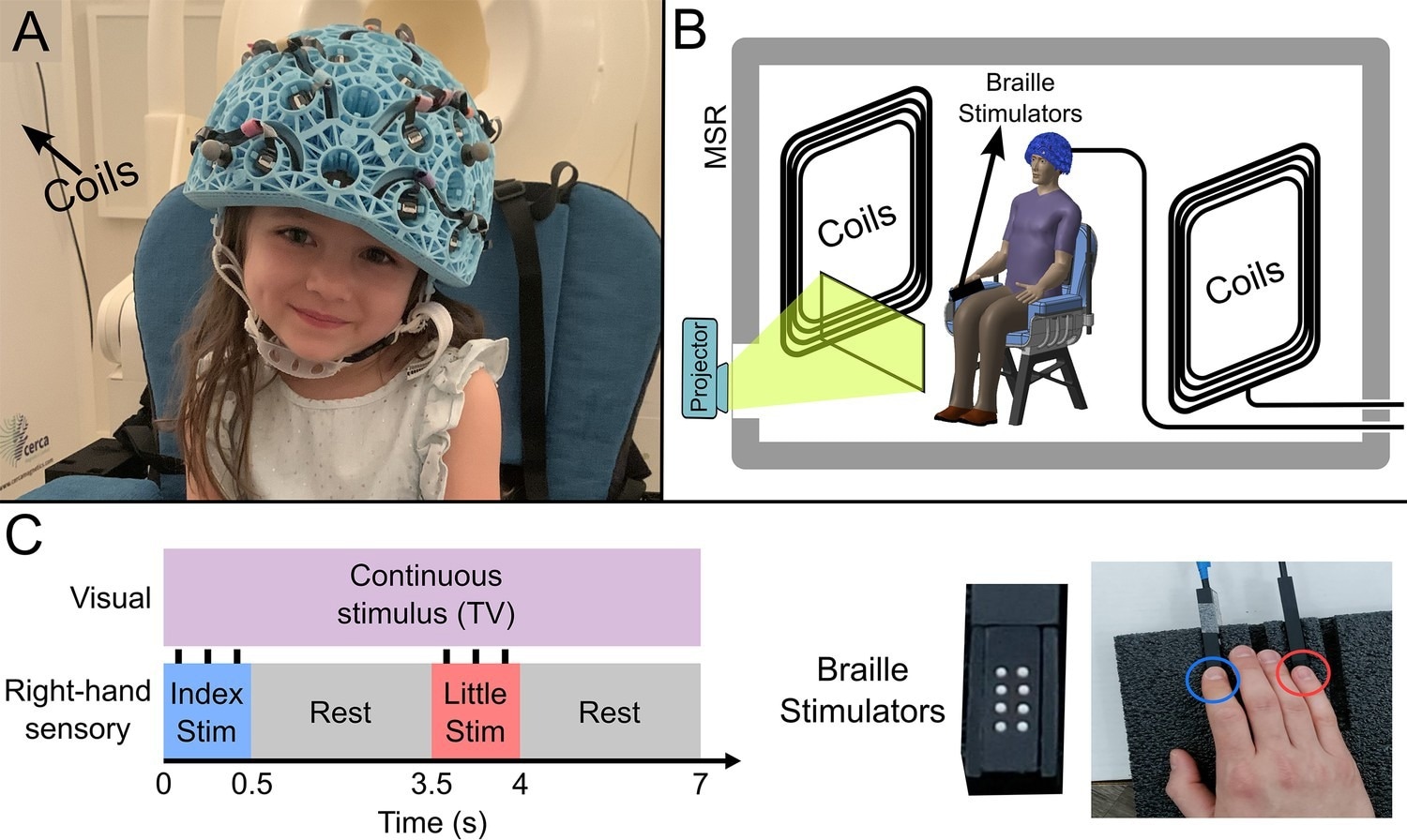 Experimental setup and beta band modulation during sensory task. (A) 4-year-old child wearing an optically pumped magnetometer-based magnetoencephalography (OPM-MEG) helmet (consent and authorisation for publication was obtained). (B) Schematic diagram of the whole system inside the shielded room. (C) Schematic illustration of stimulus timings and a photo of the somatosensory stimulators. ‘Braille’ stimulators each comprise eight pins, which can be controlled independently; all eight were used simultaneously to deliver the stimuli.