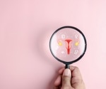 A Discussion with Hologic’s Tim Simpson on the Future of Cervical Cancer Screening
