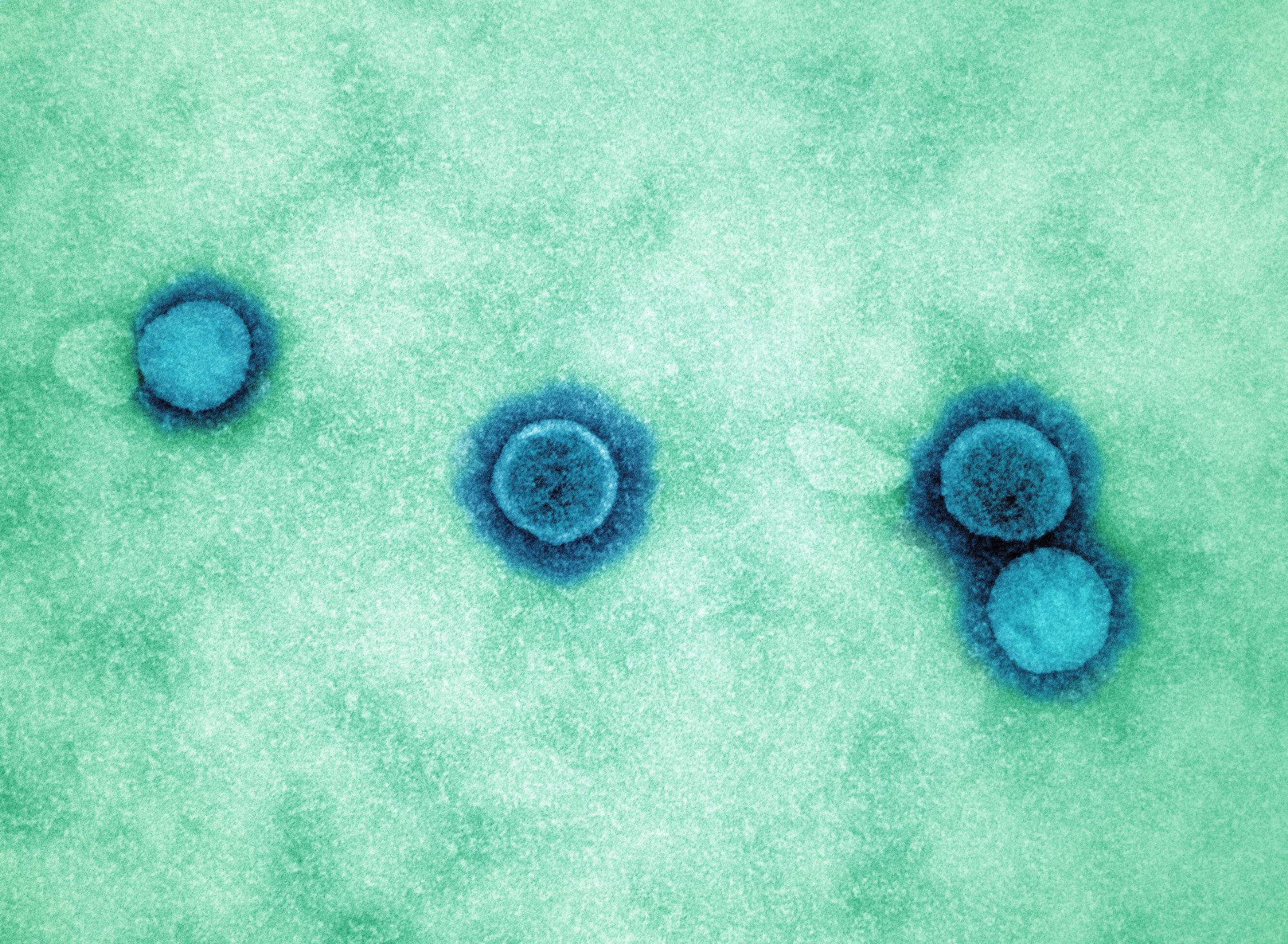 Study: Molecular mimicry in multisystem inflammatory syndrome in children. Image Credit: NIAID