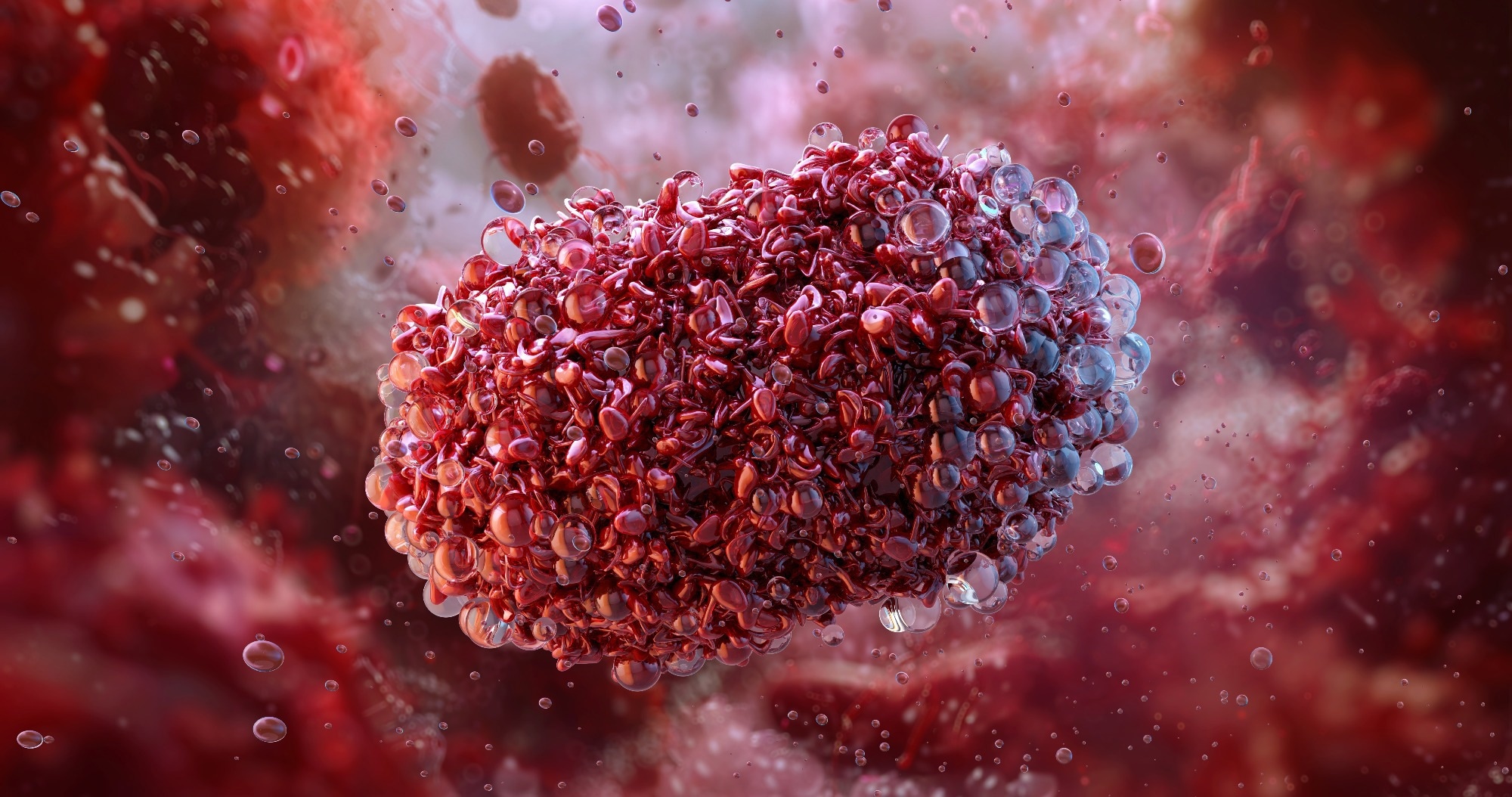 Study: International healthcare workers’ experiences and perceptions of the 2022 multi-country mpox outbreak. Image Credit: Corona Borealis Studio / Shutterstock