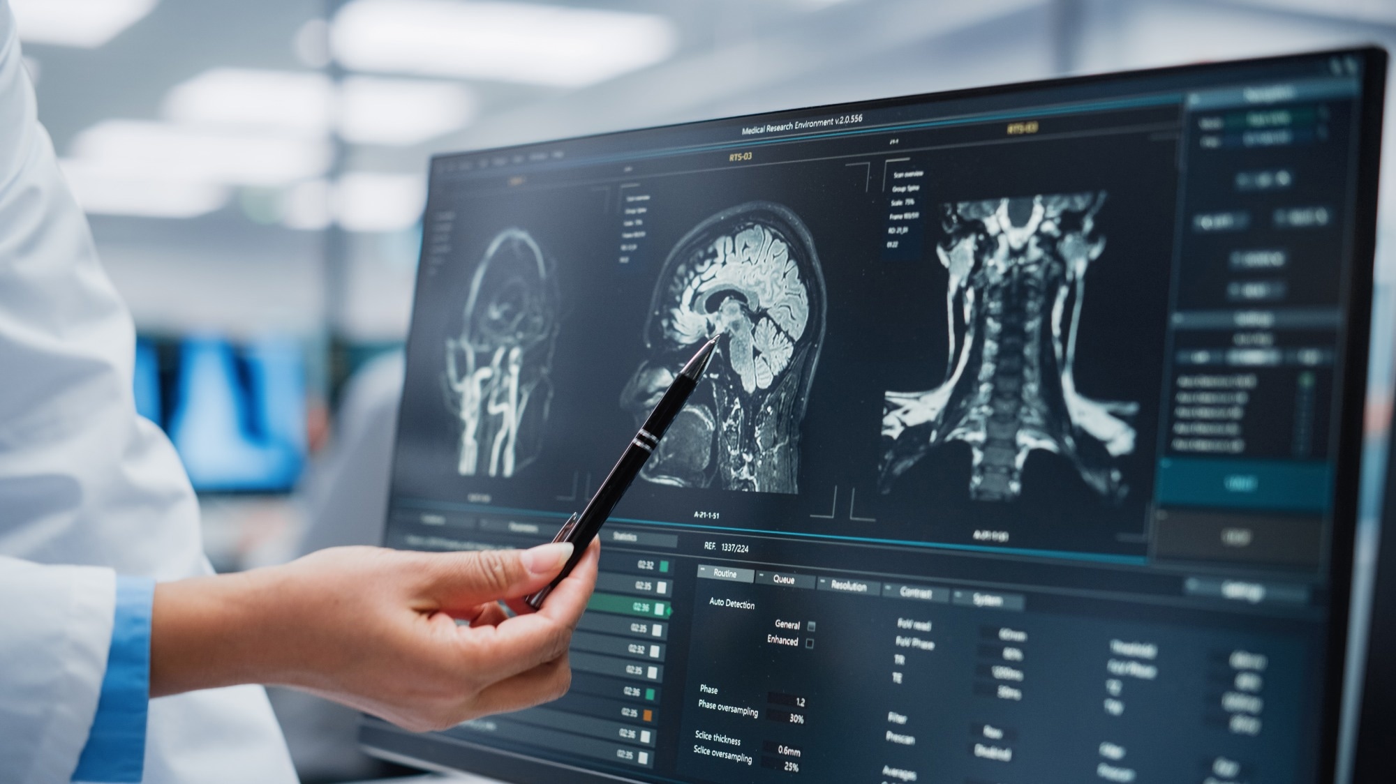 Study: Post-hospitalisation COVID-19 cognitive deficits at one year are global and associated with elevated brain injury markers and grey matter volume reduction. Image Credit: Gorodenkoff / Shutterstock