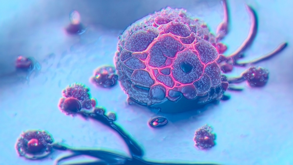 Study: CDK12 loss drives prostate cancer progression, transcription-replication conflicts, and synthetic lethality with paralog CDK13. Image Credit: Kateryna Kon/Shutterstock.com