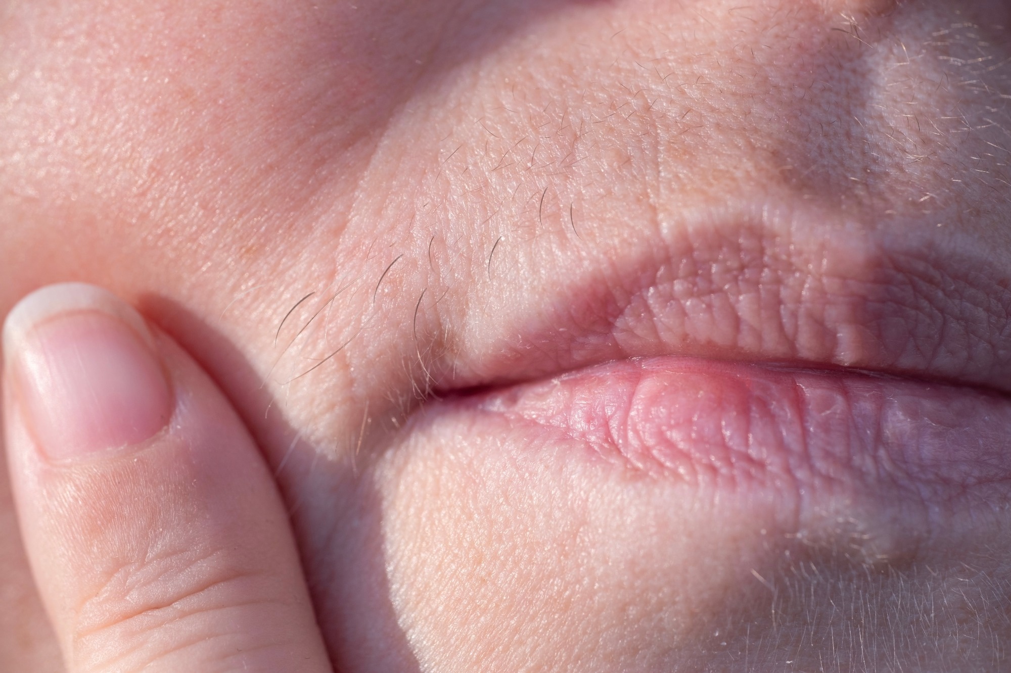 ​​​​​​​Study: Unveiling the shared genetic architecture between testosterone and polycystic ovary syndrome. Image Credit: Kittyfly/Shutterstock.com