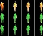 New 3D body scan method beats traditional imaging for tracking body fat