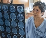 Frontotemporal dementia disrupts empathy for pain, study reveals