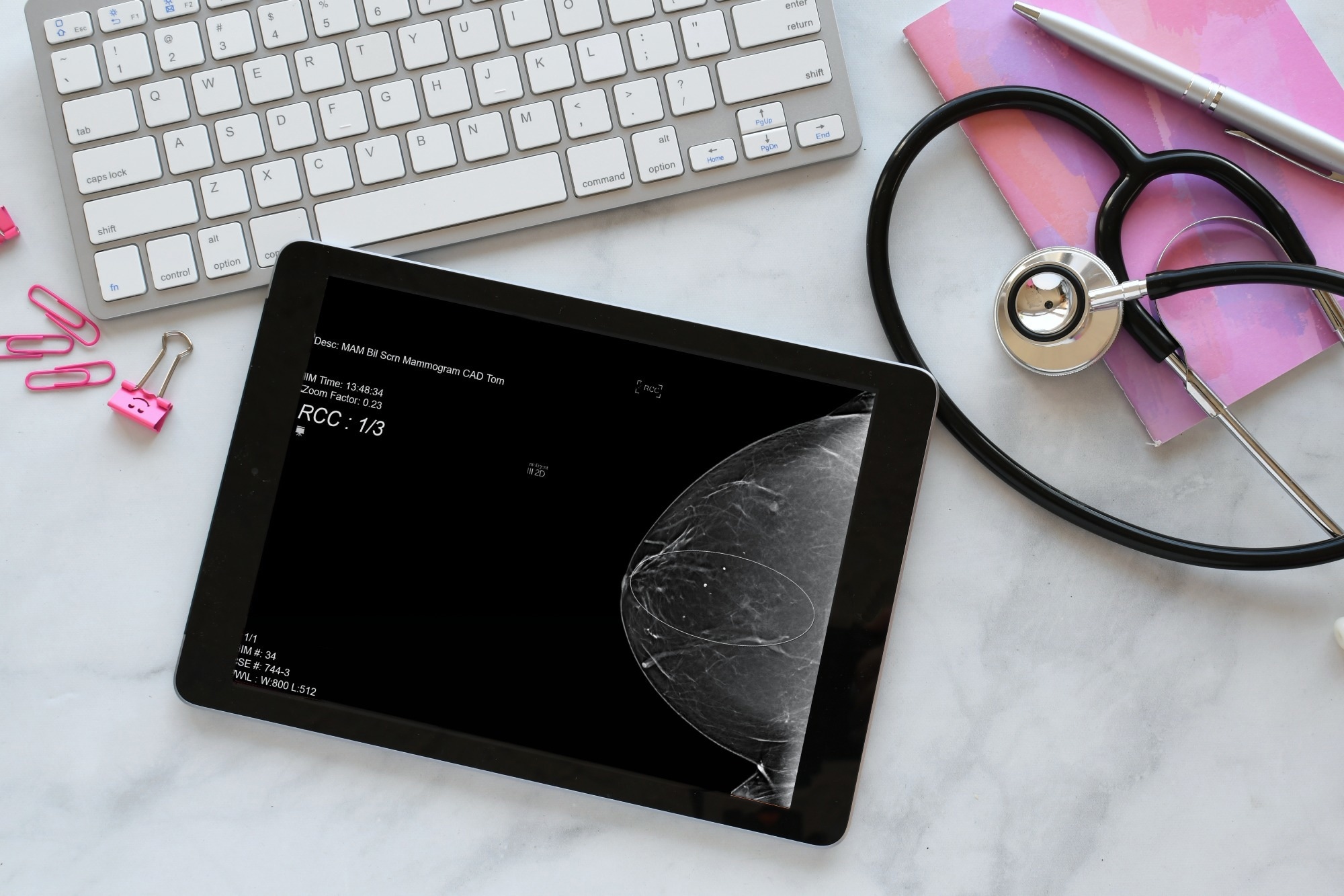 Diagnostic Mammogram scan on tablet screen of doctor or radiologist desk
