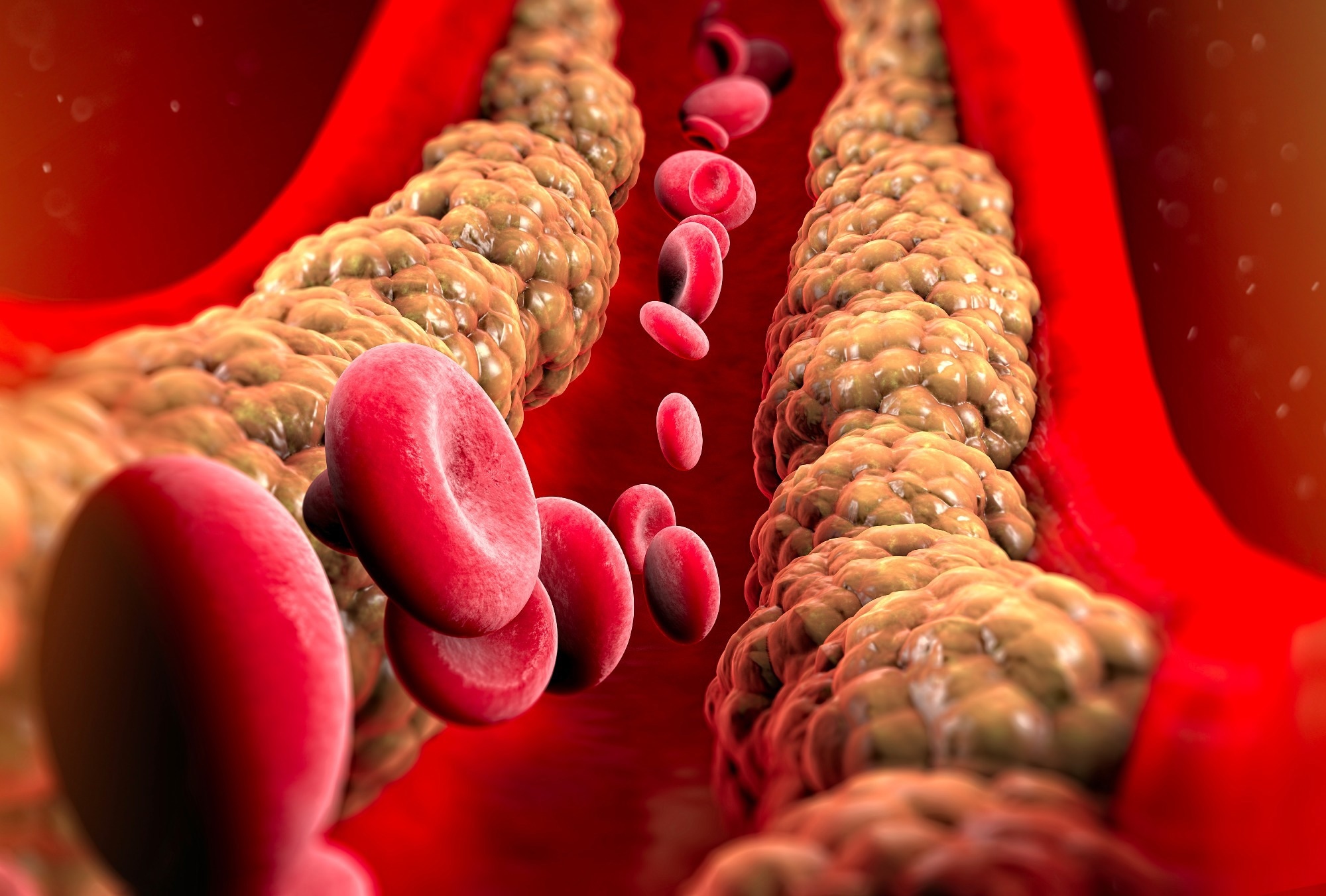 Study: Association of the triglyceride glucose index with obesity indicators and hypertension in American adults based on NHANES 2013 to 2018. Image Credit: Naeblys / Shutterstock