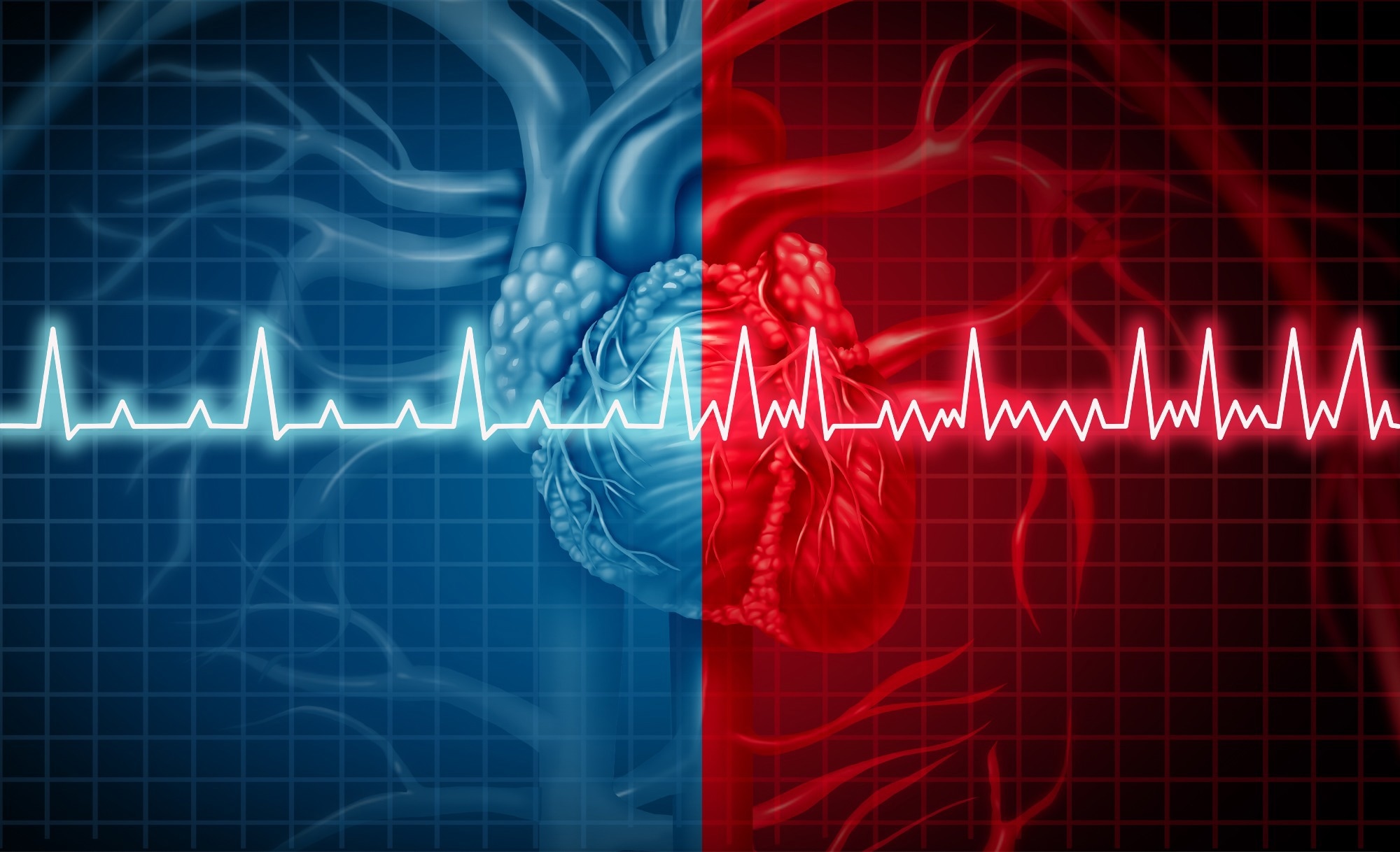 Study: Abelacimab versus Rivaroxaban in Patients with Atrial Fibrillation. Image Credit: Lightspring / Shutterstock